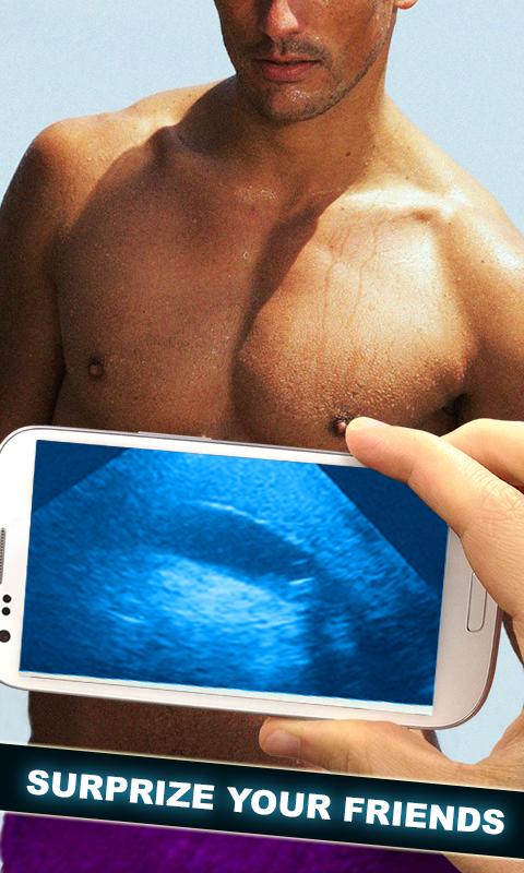 Baby Ultrasound Scanner :Prank